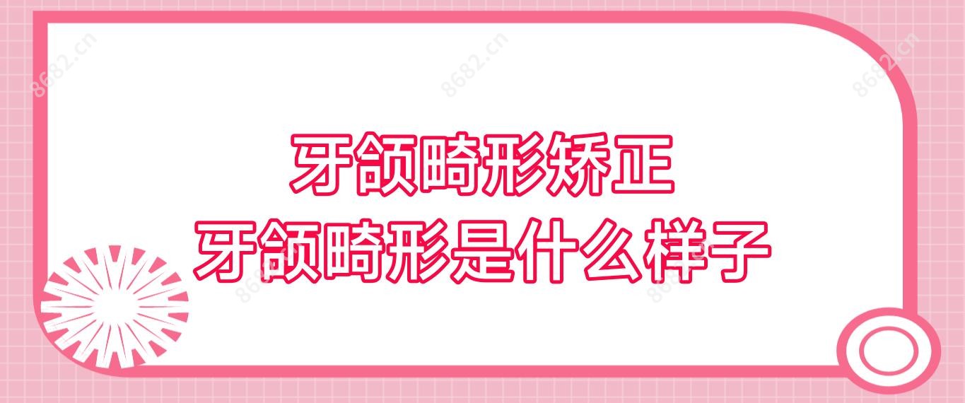 牙颌畸形矫正 牙颌畸形是什么样子