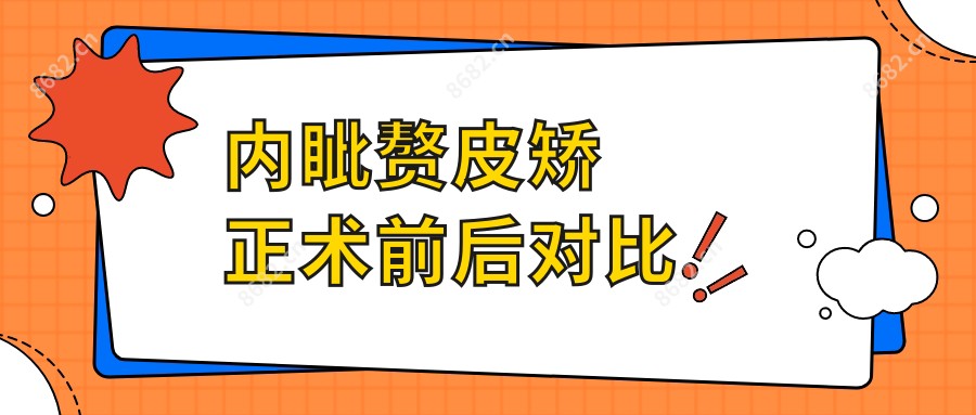 内眦赘皮矫正术前后对比