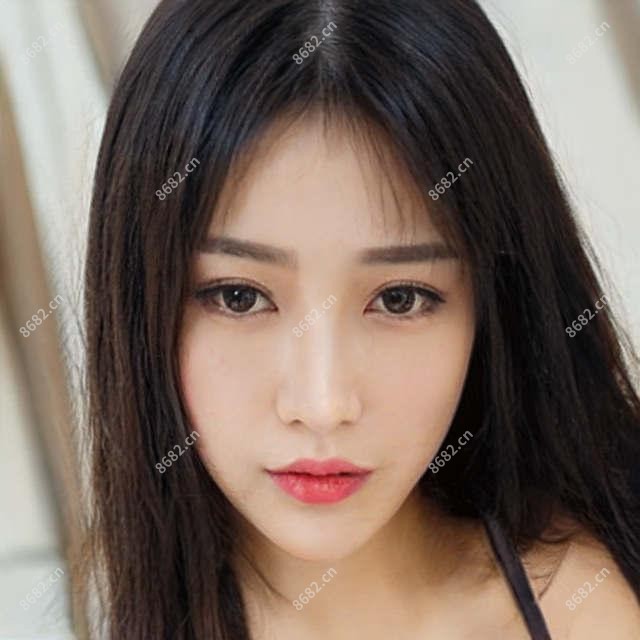 透明质酸丰唇珠要注意哪些?