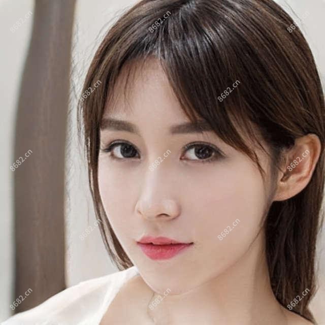 自体脂肪垫下巴指南?自体脂肪垫下巴治疗方案推荐?