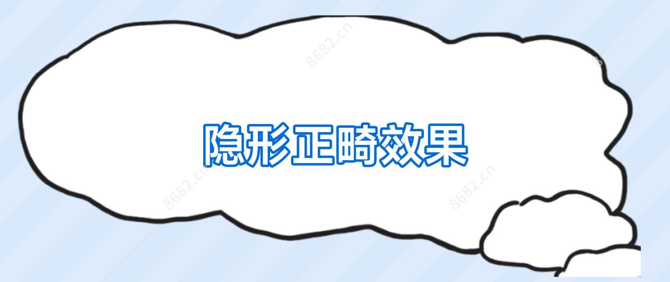 隐形正畸疗效